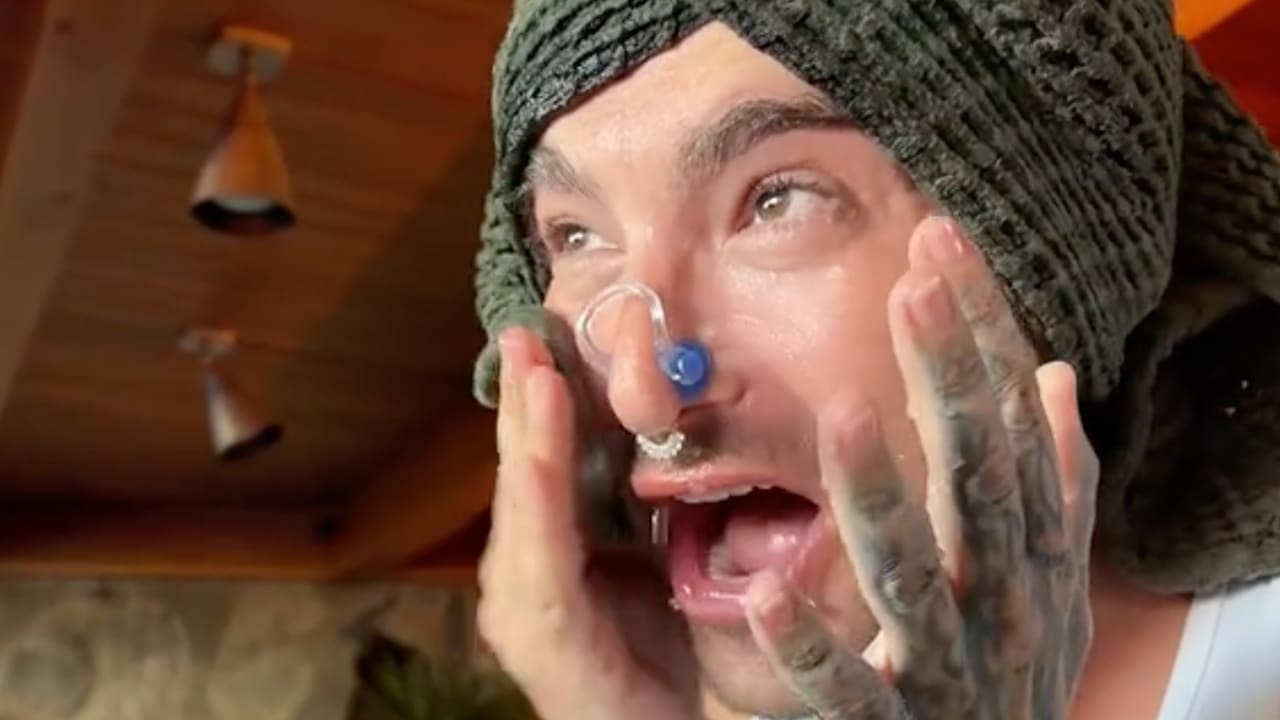 Bill Kaulitz wollte den Beauty-Trend der Stars ausprobieren: Face Icing. Was bei