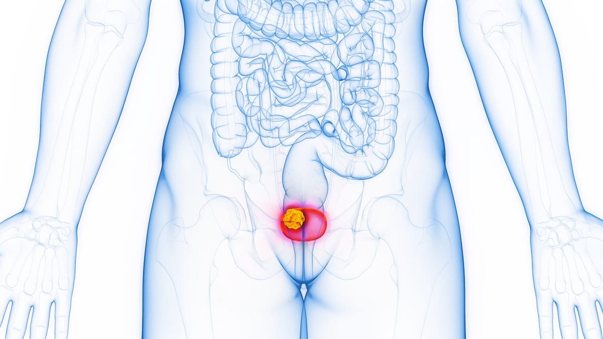 TTS-Player überspringen↵Artikel weiterlesenSie übersehen eher ein wichtiges Symptom und zahlen womöglich mit