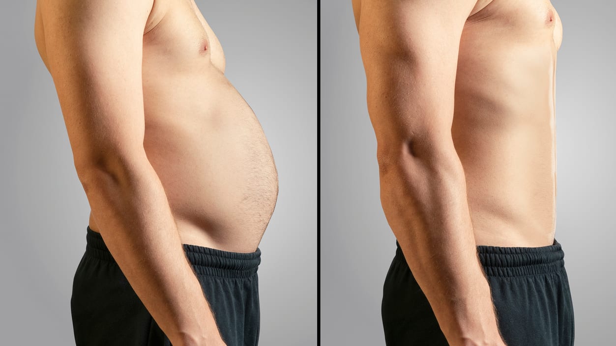 Klassische Diäten und neue Abnehm-Hypes – ob Low Carb, Keto, Null-Diät oder