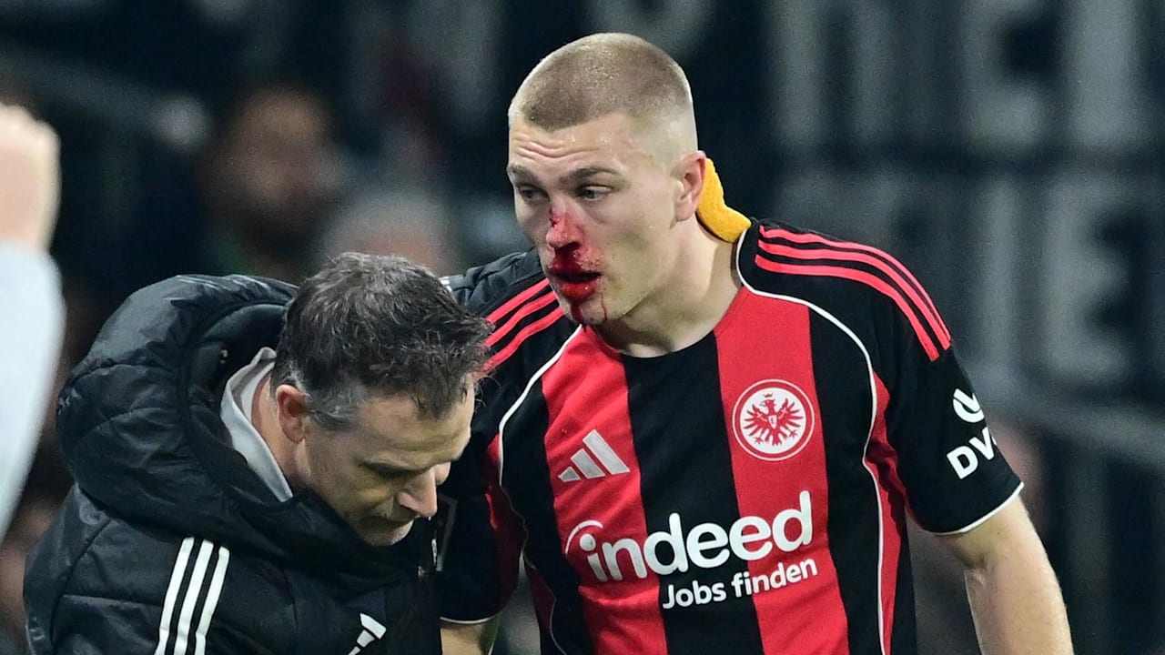 Schockierende Szene in Bremen!Werder und Frankfurt bestreiten am Freitagabend das erste Rückrundenspiel