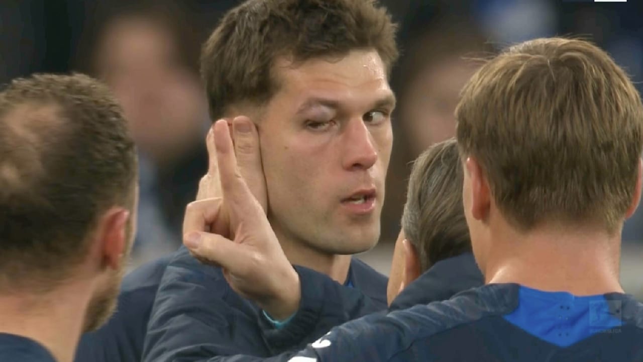 Dieses Duell tat schon beim Zuschauen weh.Nach dem 5:1 unter der Woche