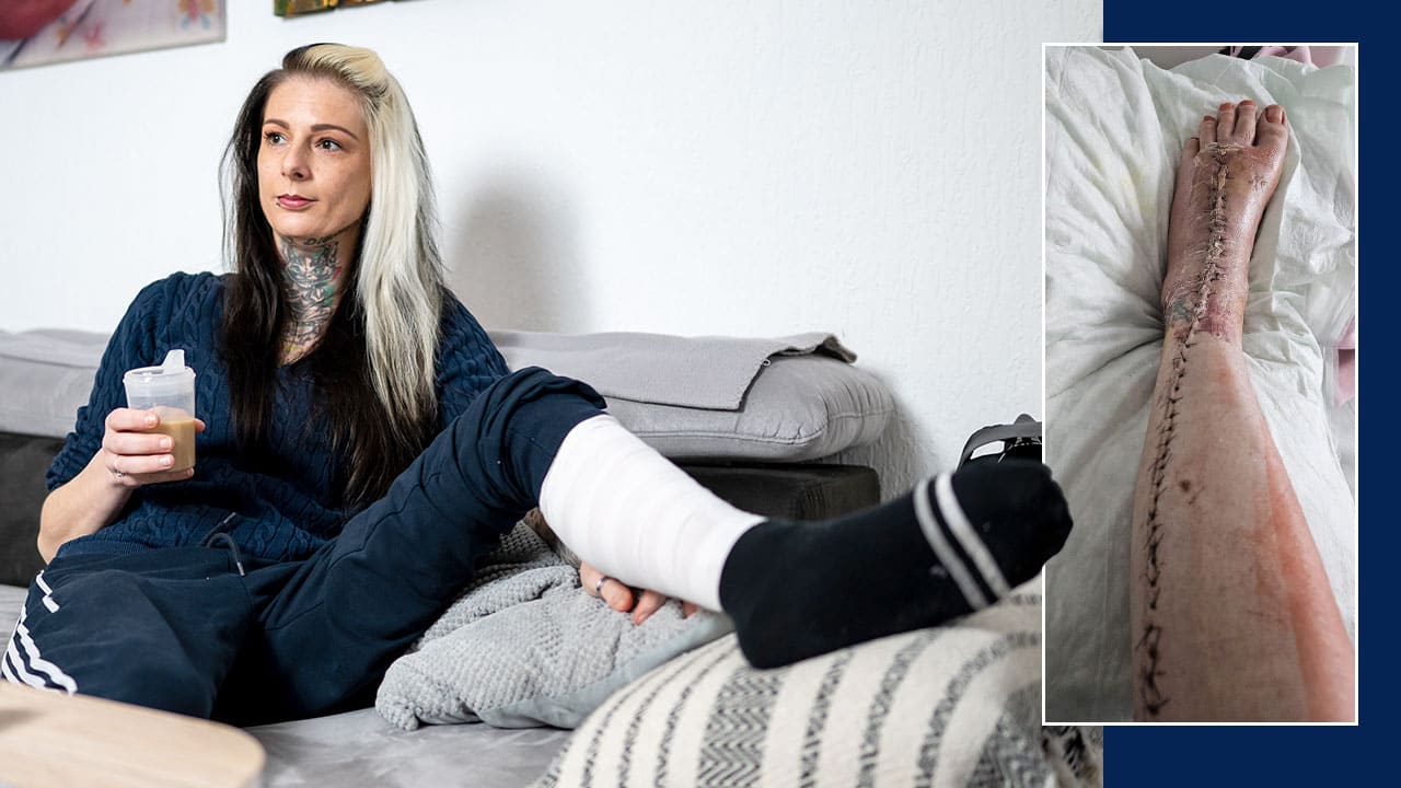 Ein winziger Mückenstich – mehr brauchte es nicht, um Cindy H. (36)