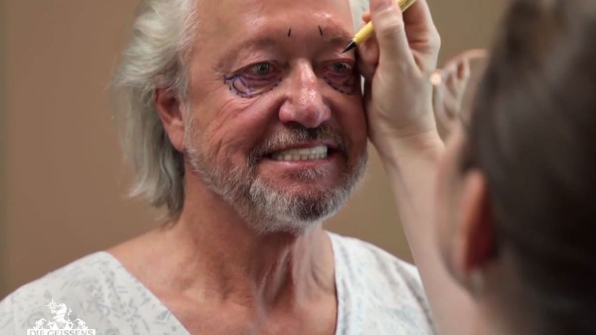 Paniek voor skoonheids-OP: Doodangs gryp Robert Geiss Paniek voor skoonheids-OP: Doodangs gry Paniek voor skoonheids-OP: Doodangs gryp Robert Ge